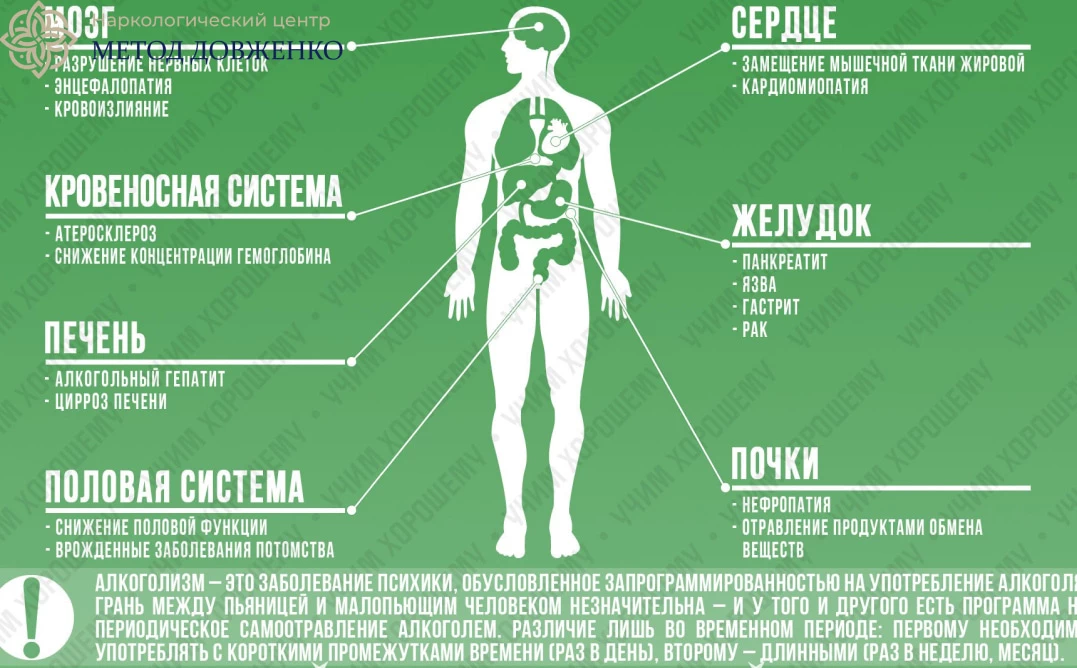 Инфографика Болезни из-за алкоголизма