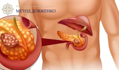 Проблемы с поджелудочной железой: алкогольный панкреатит